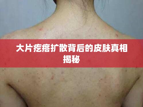 大片疙瘩扩散背后的皮肤真相揭秘