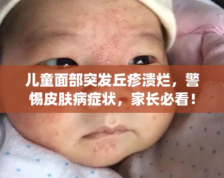 儿童面部突发丘疹溃烂，警惕皮肤病症状，家长必看！