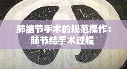肺结节手术的规范操作：肺节结手术过程 