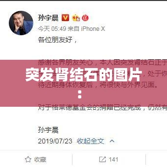 突发肾结石的图片： 