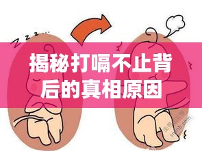 揭秘打嗝不止背后的真相原因