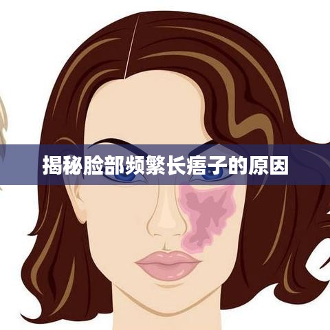 揭秘脸部频繁长痦子的原因