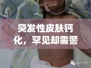 突发性皮肤钙化，罕见却需警惕的皮肤病