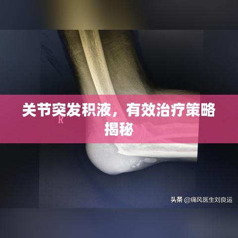 一石三鸟