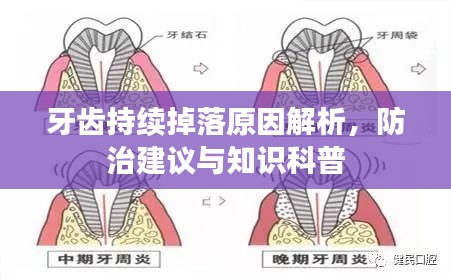 牙齿持续掉落原因解析，防治建议与知识科普